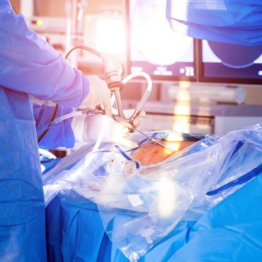 Surgeons perform spine surgery in modern operating room. Doctors making operation. Medical instruments. Operating theatre. Medical concept; Things to Do Before Having Spine Surgery